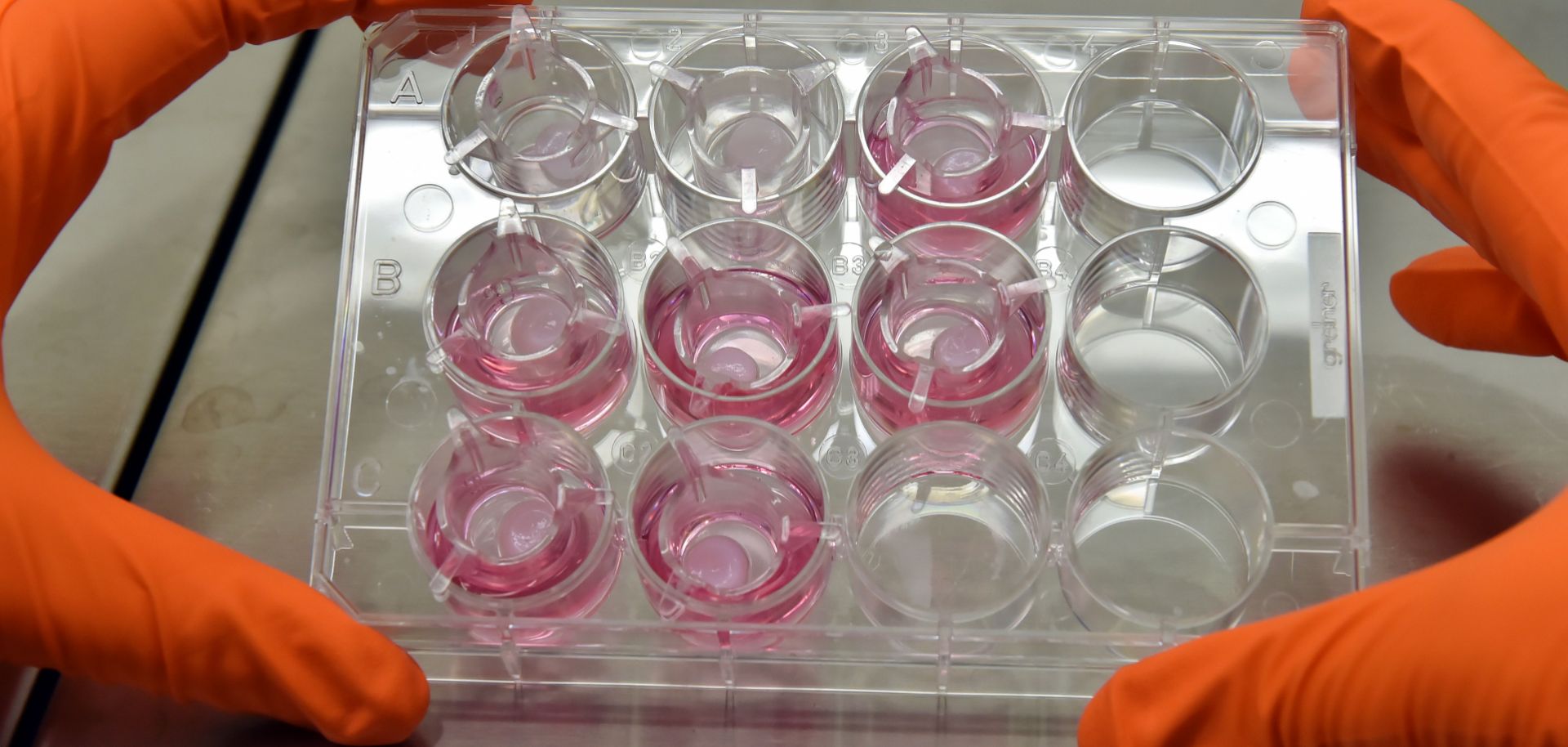 A laboratory engineer controls the quality of a preparation at a biotechnology company in southwestern France in 2016.